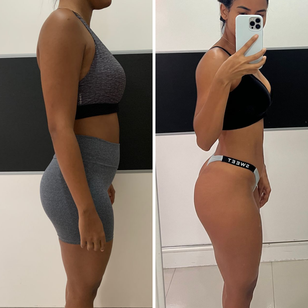Antes e depois — foco bumbum e perna